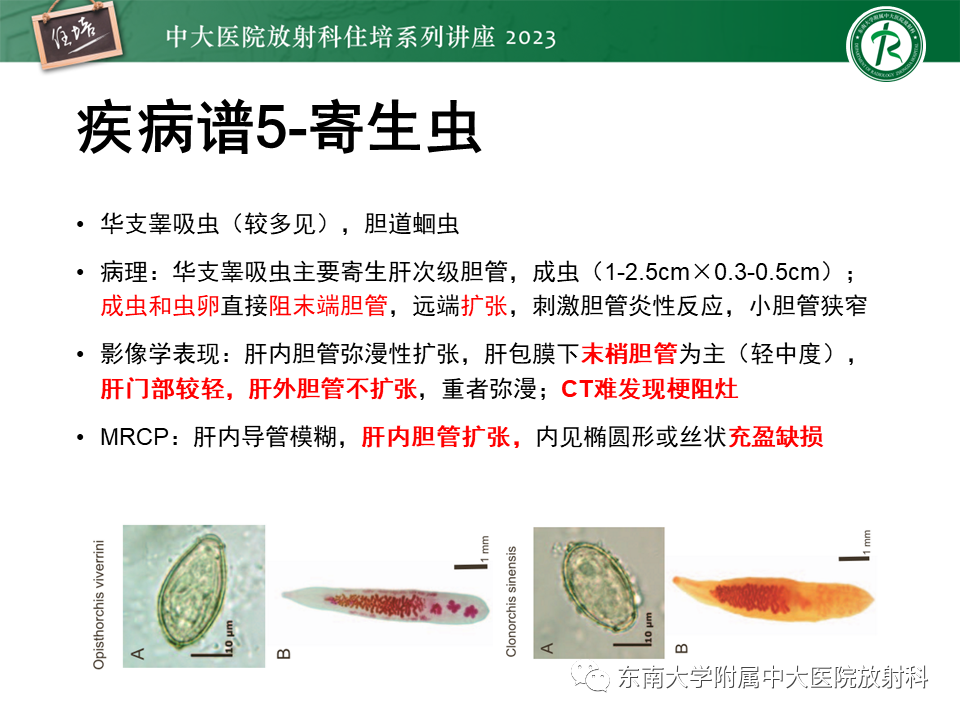影像PPT - 【PPT】继发性肝内胆管局部扩张影像诊断-38