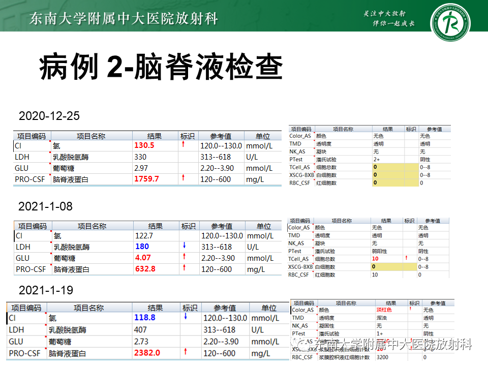 影像PPT - 【PPT】成人脑白质受累为主的弥漫/融合分布病变的诊断思路-5