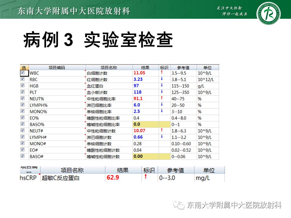影像PPT - 【PPT】成人脑白质受累为主的弥漫/融合分布病变的诊断思路-10