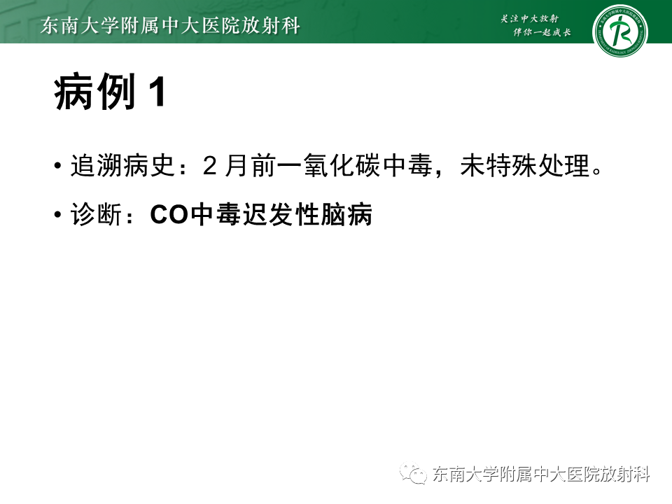 影像PPT - 【PPT】成人脑白质受累为主的弥漫/融合分布病变的诊断思路-16