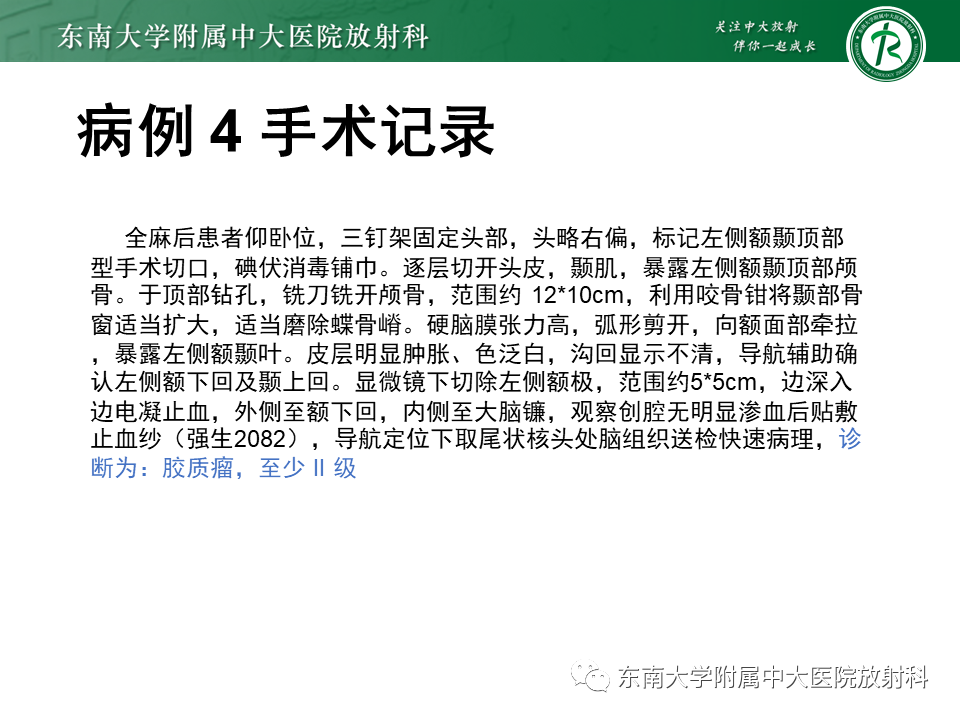 影像PPT - 【PPT】成人脑白质受累为主的弥漫/融合分布病变的诊断思路-19