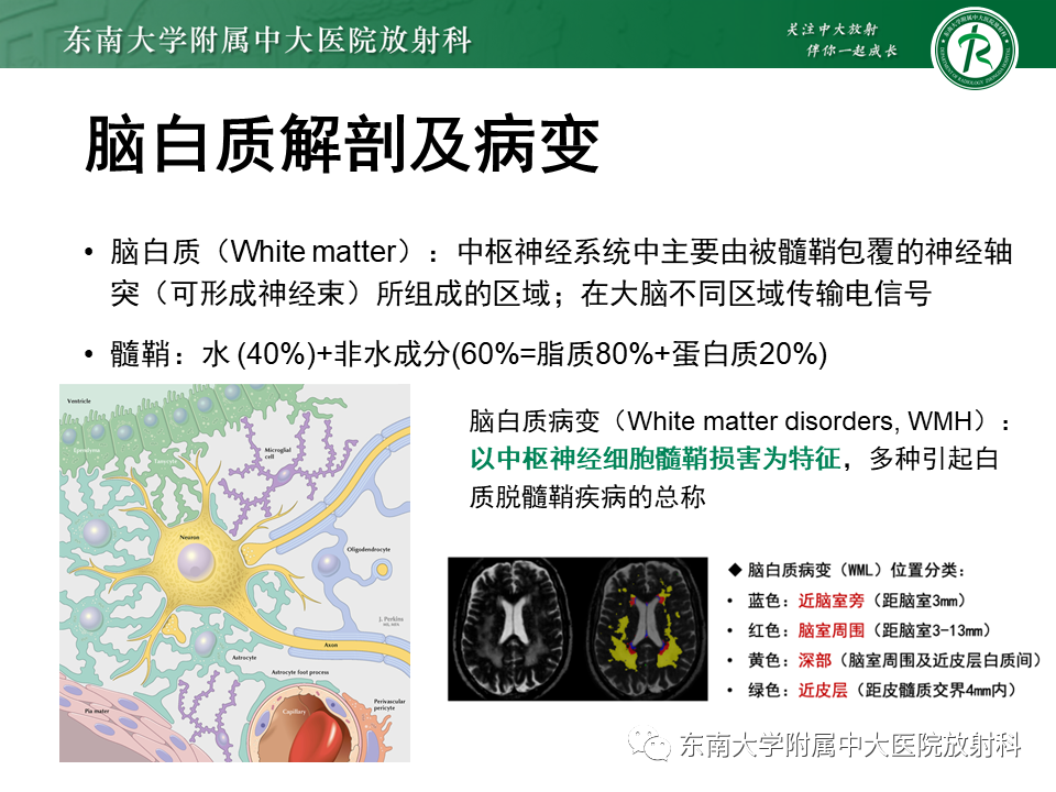 影像PPT - 【PPT】成人脑白质受累为主的弥漫/融合分布病变的诊断思路-24