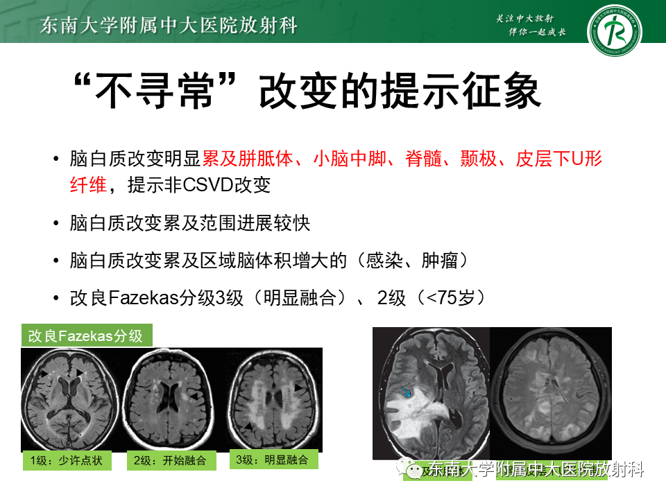 影像PPT - 【PPT】成人脑白质受累为主的弥漫/融合分布病变的诊断思路-27