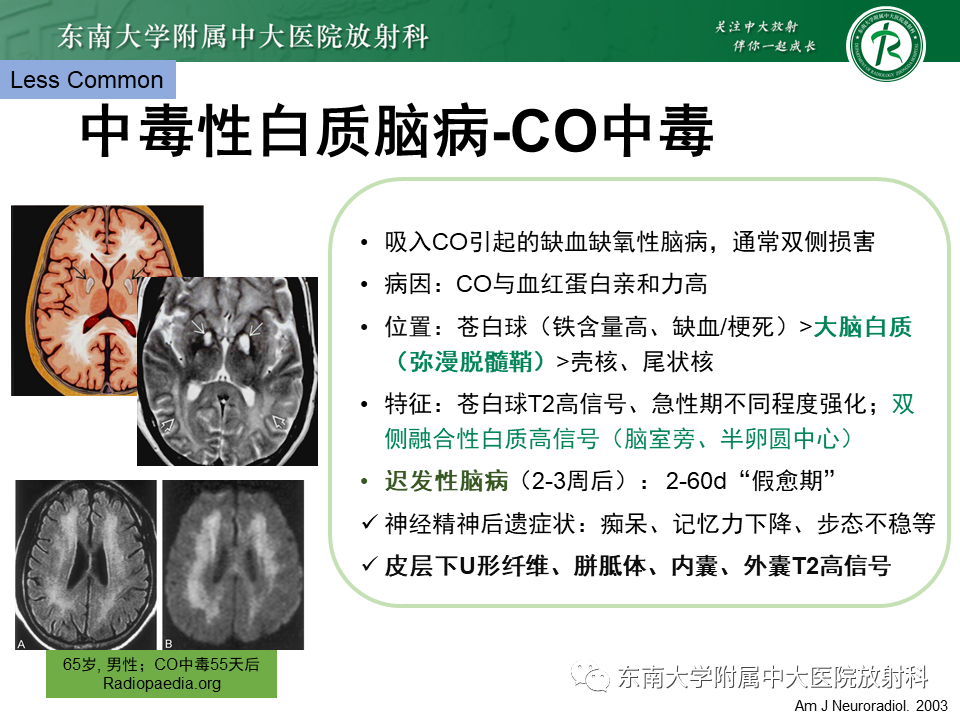 影像PPT - 【PPT】成人脑白质受累为主的弥漫/融合分布病变的诊断思路-34