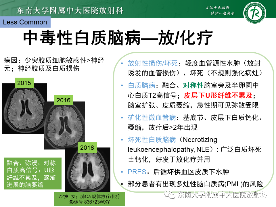 影像PPT - 【PPT】成人脑白质受累为主的弥漫/融合分布病变的诊断思路-35