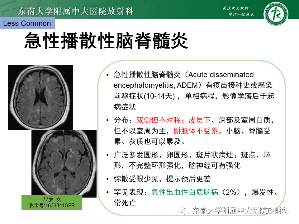 影像PPT - 【PPT】成人脑白质受累为主的弥漫/融合分布病变的诊断思路-38
