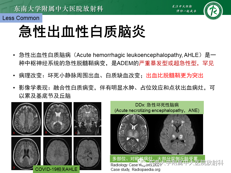 影像PPT - 【PPT】成人脑白质受累为主的弥漫/融合分布病变的诊断思路-39
