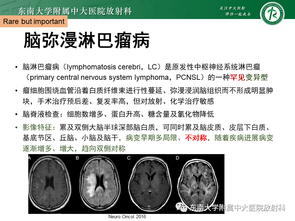 影像PPT - 【PPT】成人脑白质受累为主的弥漫/融合分布病变的诊断思路-42