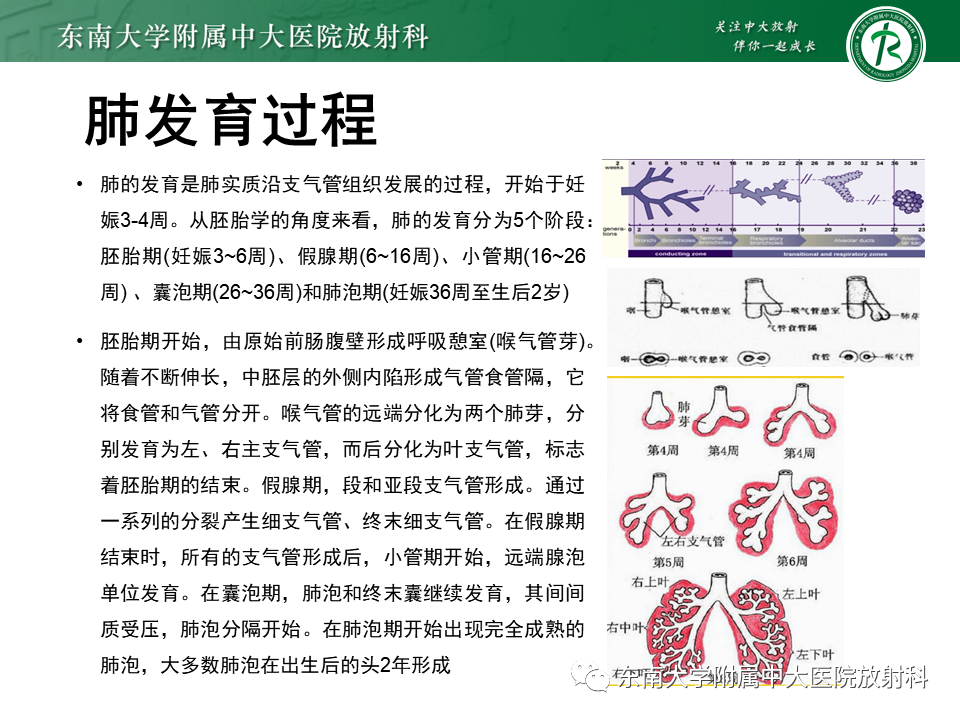 影像PPT - 【PPT】先天性肺气道畸形（CPAM）-7