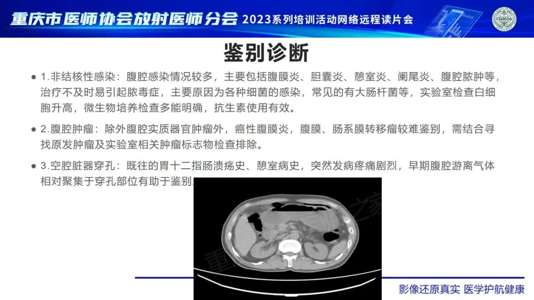 影像PPT - 【病例】腹腔结核/结核性腹膜炎1例CT影像-9