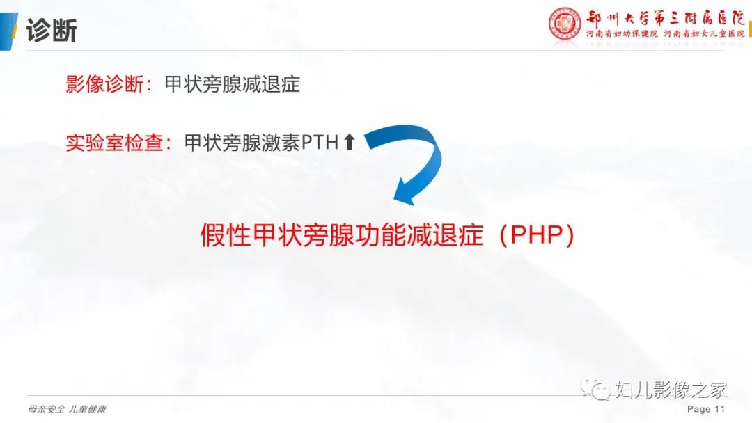 影像PPT - 【PPT】假性甲状旁腺功能减退症-11