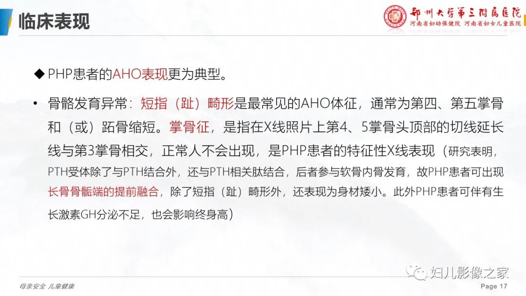 影像PPT - 【PPT】假性甲状旁腺功能减退症-17