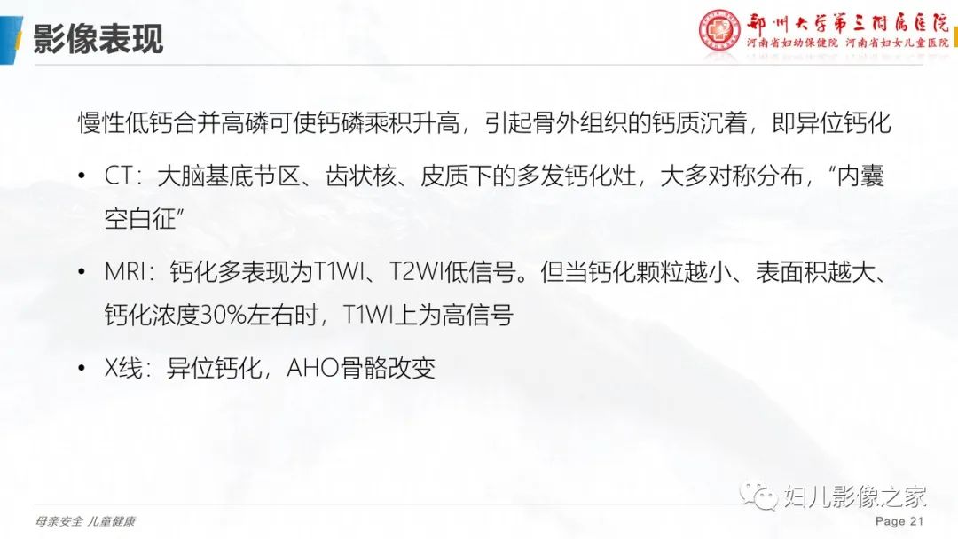 影像PPT - 【PPT】假性甲状旁腺功能减退症-21