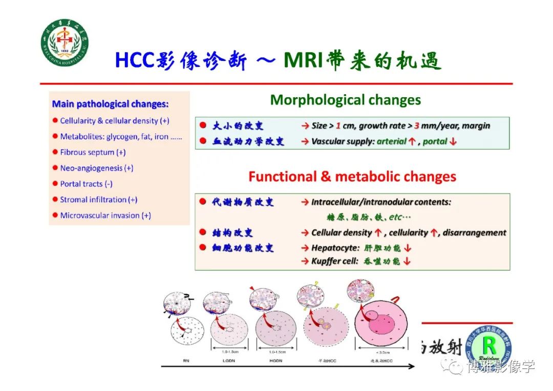 影像PPT - 【PPT】肝硬化结节多步癌变的影像学评价-11