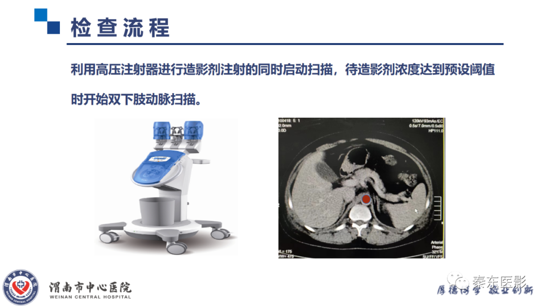 影像PPT - 【PPT】双下肢CTA检查技术-9