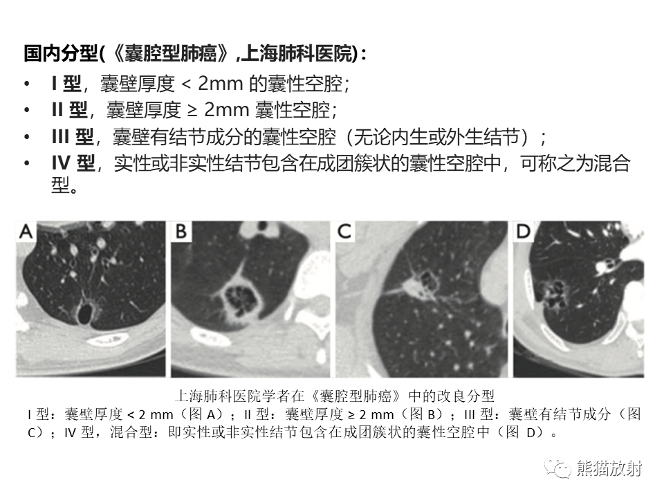 影像PPT - 【病例】肺部囊腔样病变2例CT鉴别-27