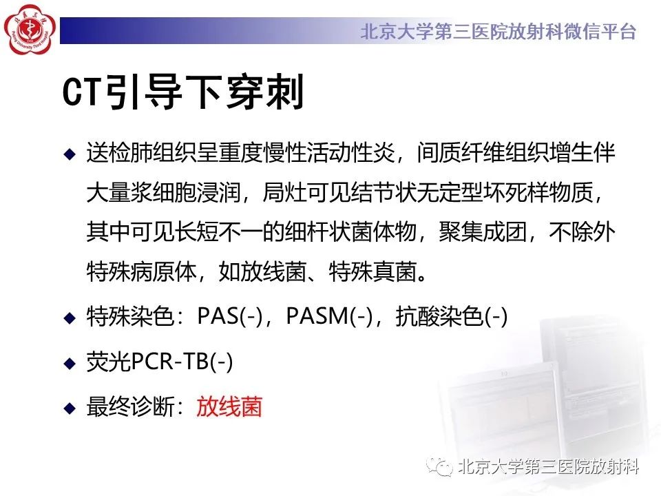 影像PPT - 【PPT】肺放线菌-6