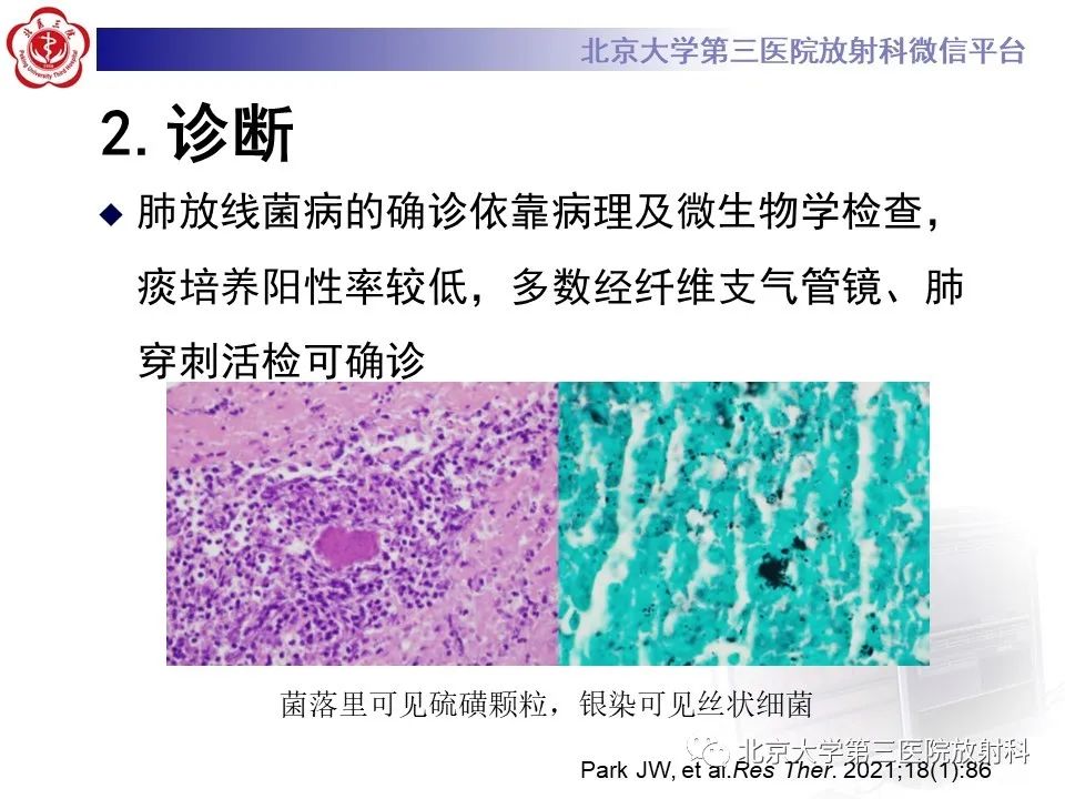 影像PPT - 【PPT】肺放线菌-9