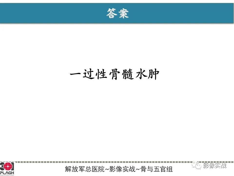 影像PPT - 【病例】股骨头一过性骨髓水肿1例X线MR-7
