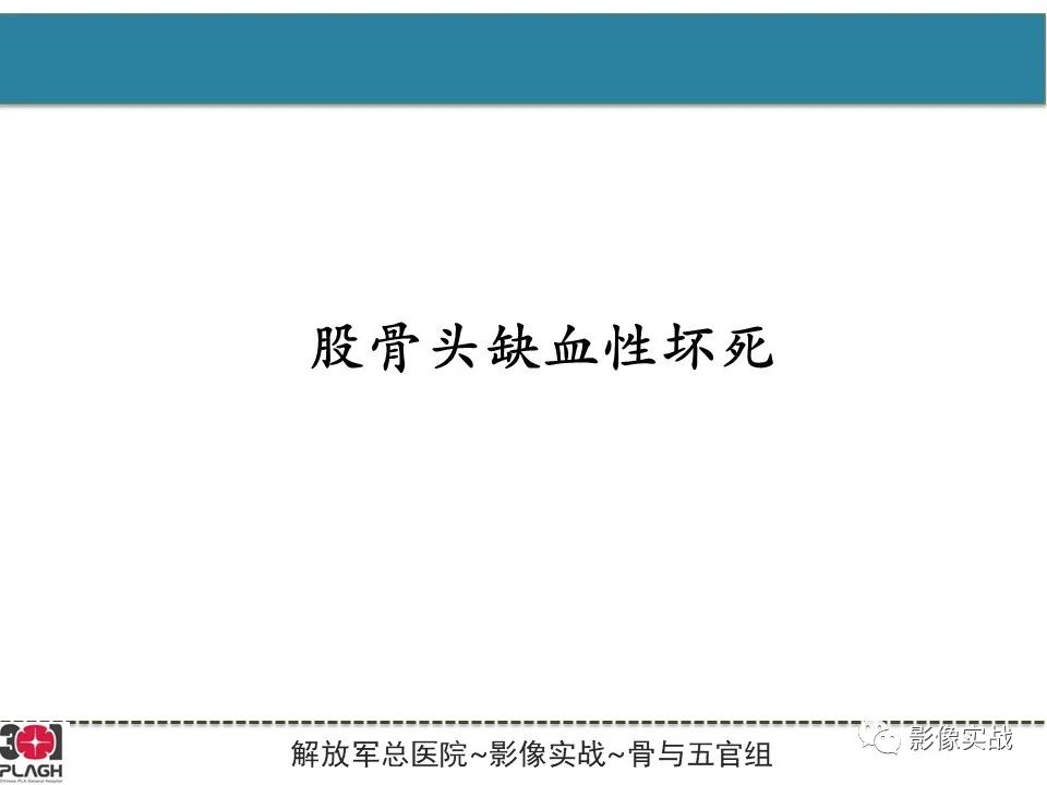 影像PPT - 【病例】股骨头一过性骨髓水肿1例X线MR-9