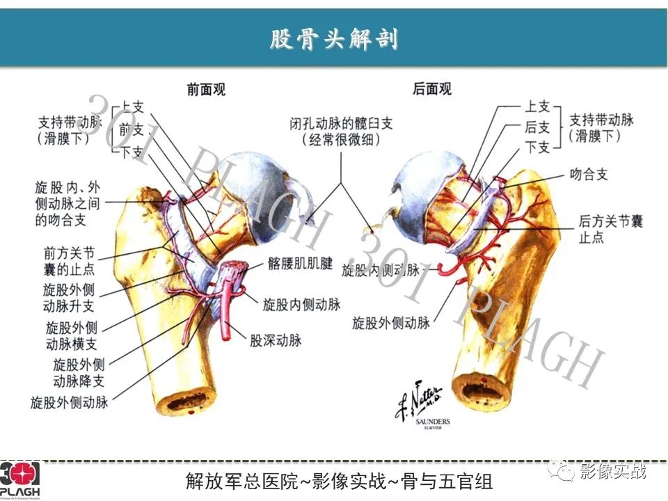 影像PPT - 【病例】股骨头一过性骨髓水肿1例X线MR-10