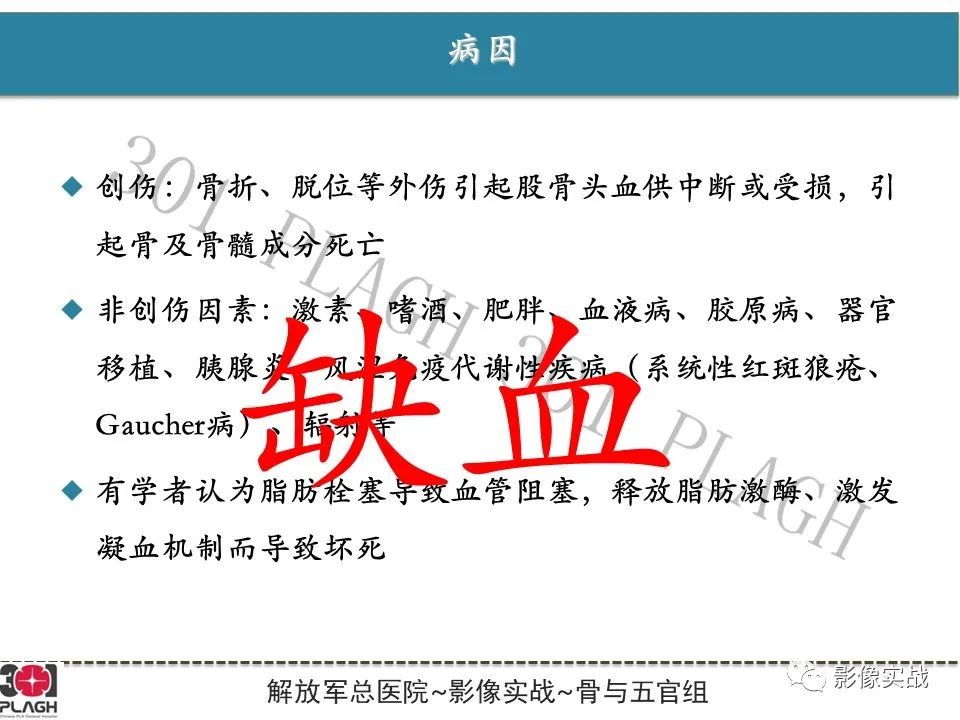 影像PPT - 【病例】股骨头一过性骨髓水肿1例X线MR-12