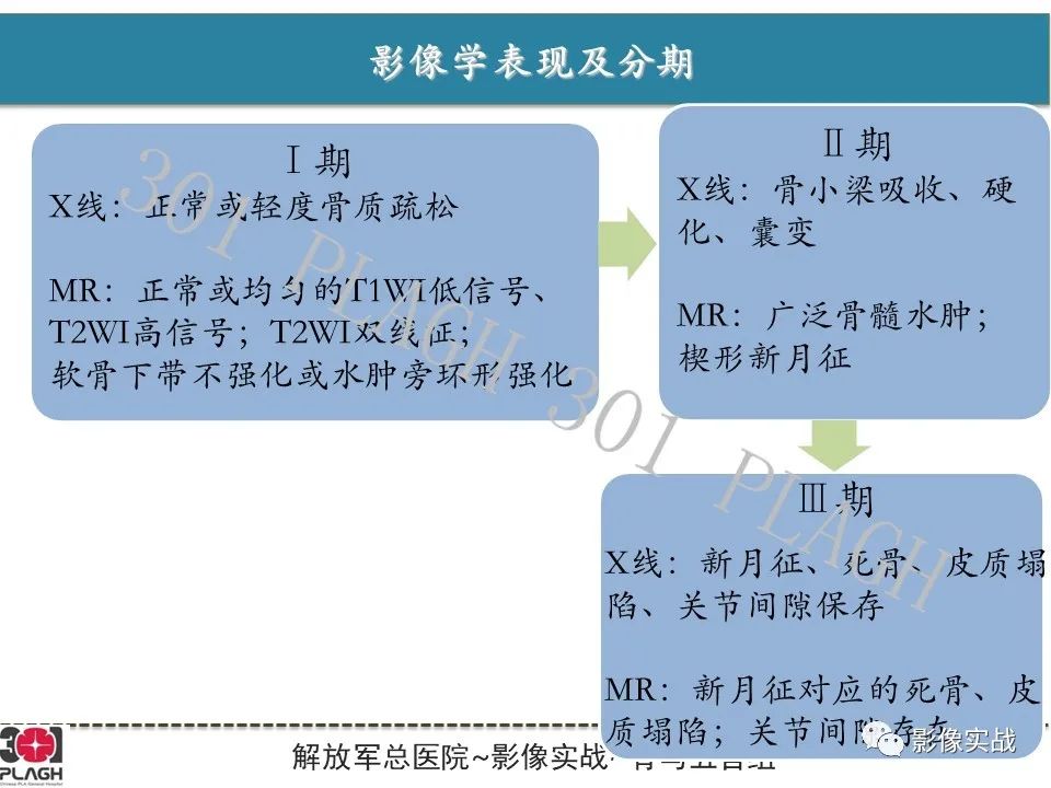 影像PPT - 【病例】股骨头一过性骨髓水肿1例X线MR-21