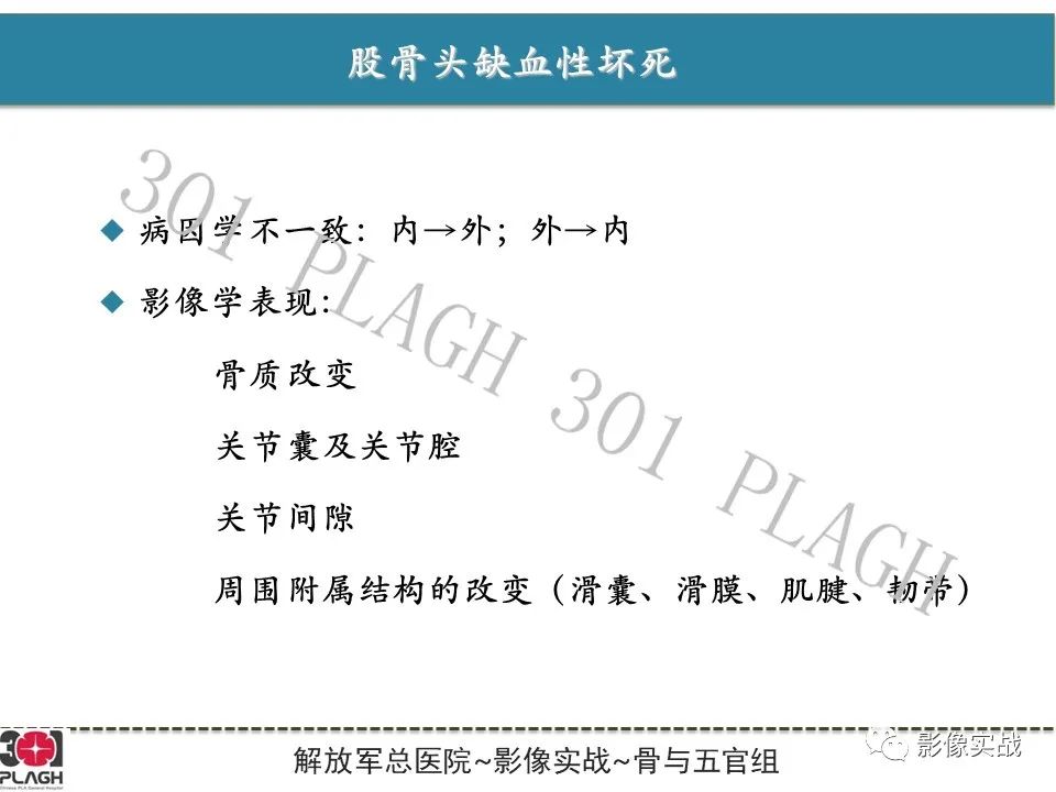 影像PPT - 【病例】股骨头一过性骨髓水肿1例X线MR-29
