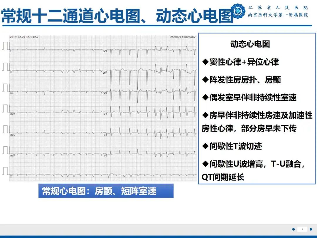 影像PPT - 【PPT】铁过载心肌病-4