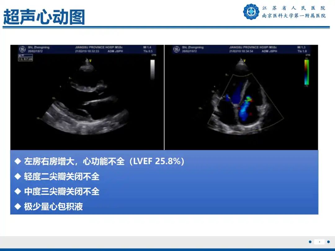 影像PPT - 【PPT】铁过载心肌病-5