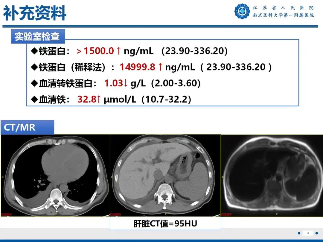影像PPT - 【PPT】铁过载心肌病-20