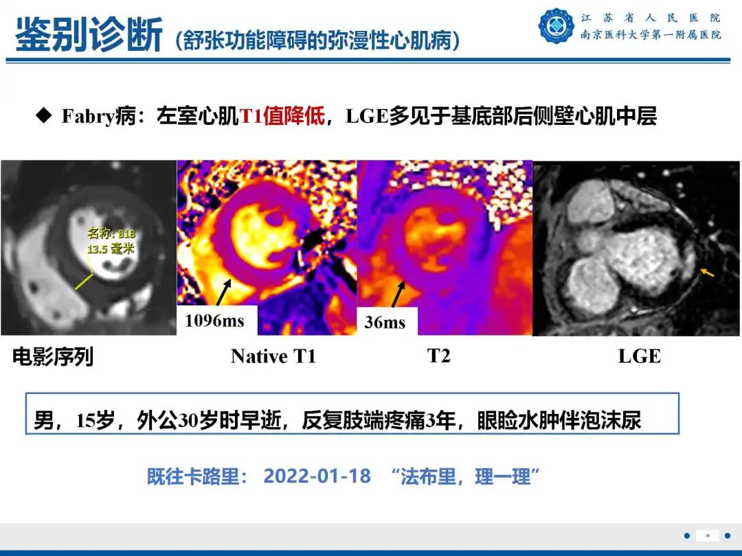 影像PPT - 【PPT】铁过载心肌病-39