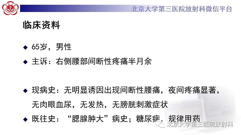 影像PPT - 【PPT】原发性肾上腺淋巴瘤-2