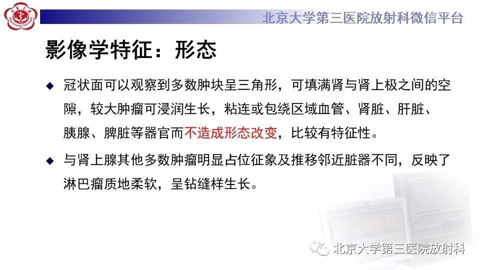 影像PPT - 【PPT】原发性肾上腺淋巴瘤-14