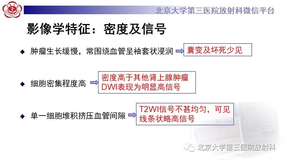影像PPT - 【PPT】原发性肾上腺淋巴瘤-15