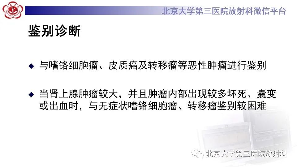 影像PPT - 【PPT】原发性肾上腺淋巴瘤-18