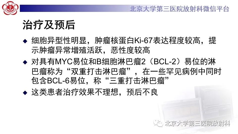 影像PPT - 【PPT】原发性肾上腺淋巴瘤-24