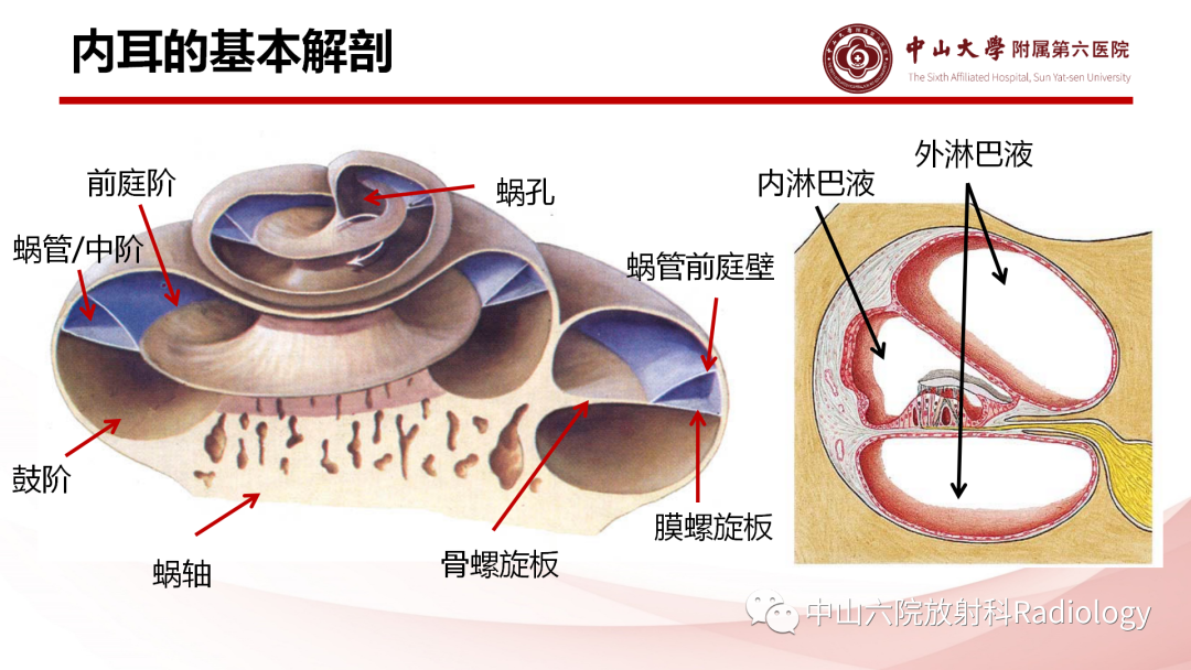影像PPT - 【PPT】梅尼埃病的影像学诊断-4