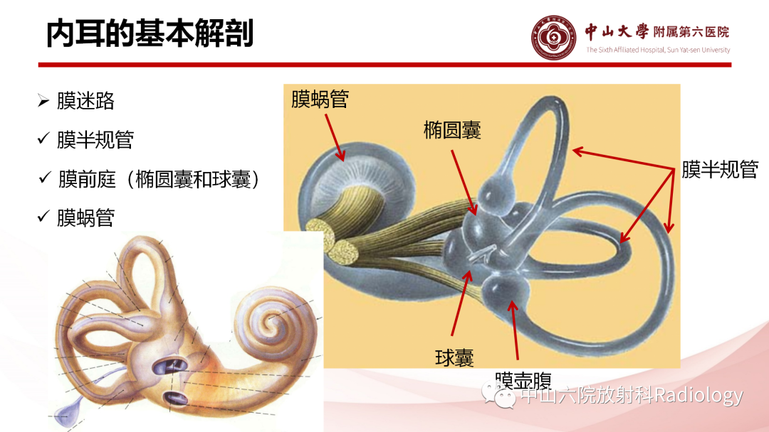 影像PPT - 【PPT】梅尼埃病的影像学诊断-3
