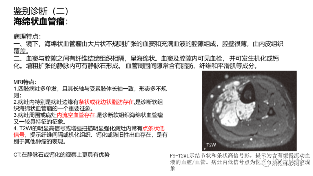 影像PPT - 【病例】小腿腺泡状软组织肉瘤 VS 黏液样脂肪肉瘤-38