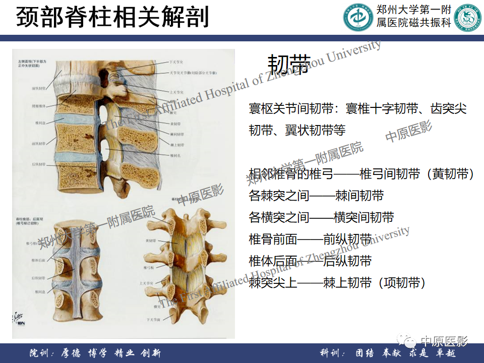 影像PPT - 【PPT】磁共振在颈椎病中的应用-5