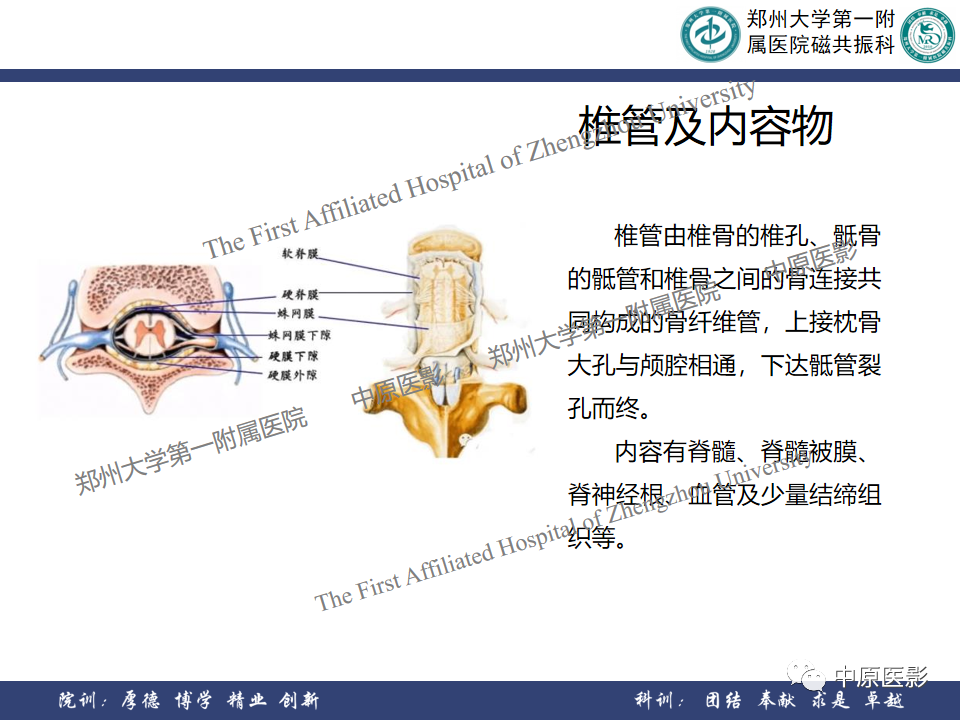 影像PPT - 【PPT】磁共振在颈椎病中的应用-7