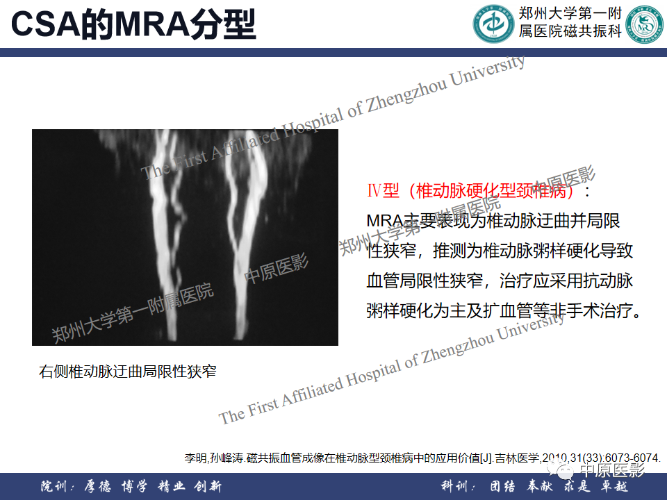 影像PPT - 【PPT】磁共振在颈椎病中的应用-44