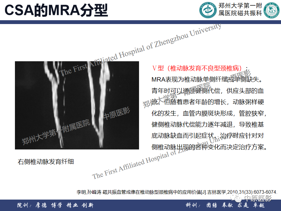 影像PPT - 【PPT】磁共振在颈椎病中的应用-45