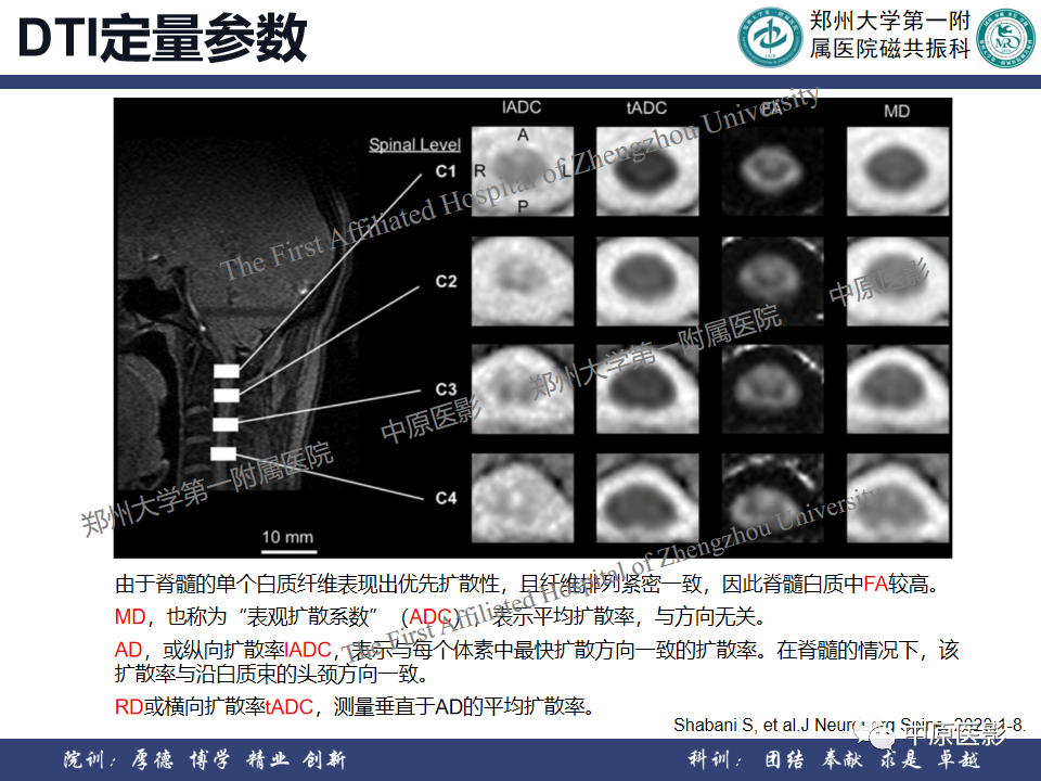 影像PPT - 【PPT】磁共振在颈椎病中的应用-51