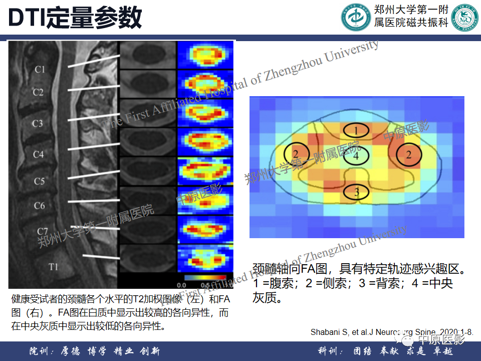 影像PPT - 【PPT】磁共振在颈椎病中的应用-52