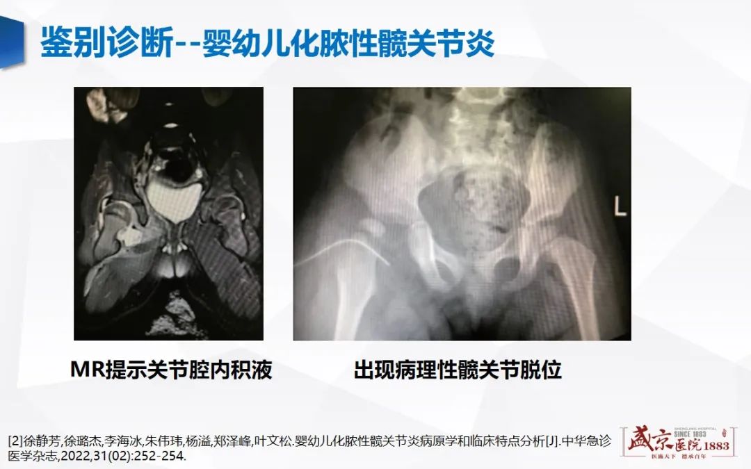 影像PPT - 【PPT】发育性髋关节发育不良-12