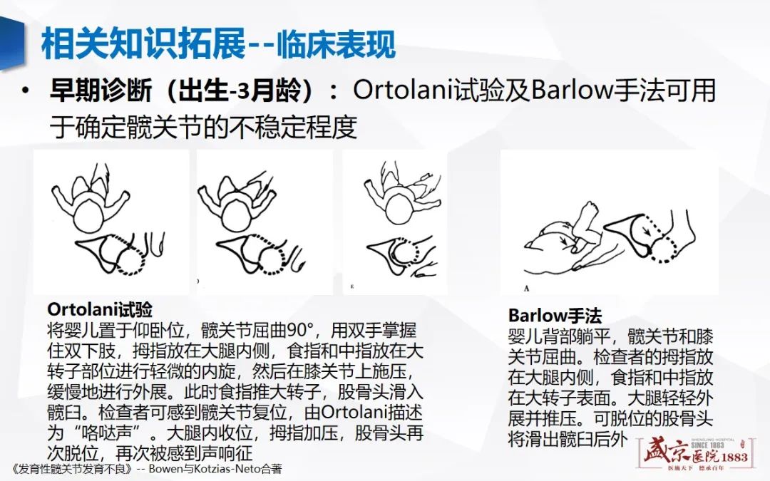 影像PPT - 【PPT】发育性髋关节发育不良-17