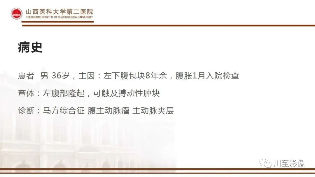影像PPT - 【PPT】马方综合征-2