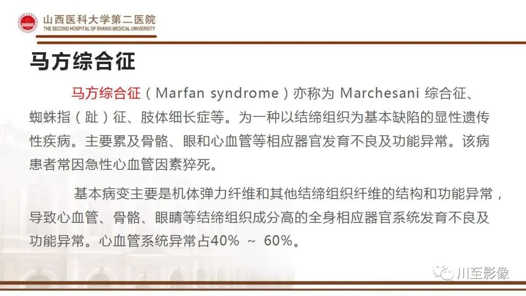 影像PPT - 【PPT】马方综合征-6